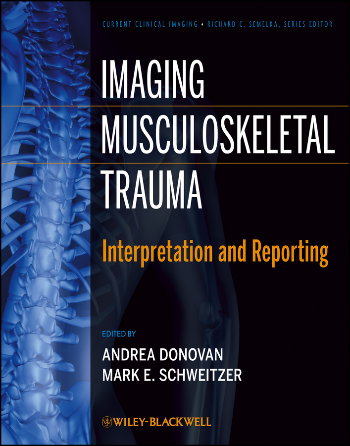 biomechanics of musculoskeletal injury pdf
