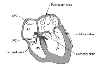 Understanding Intracardiac EGMs and ECGs