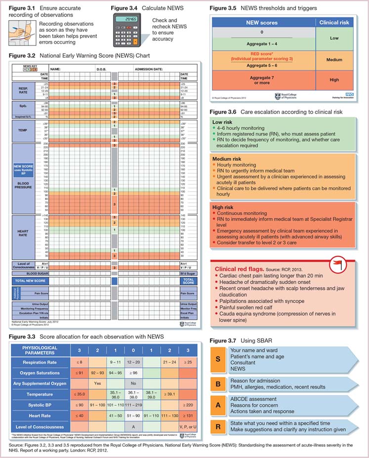 Diagram shows score allocation for each observation with NEWS, Using SBAR, Clinical red flags (Painful swollen red calf, Headache of dramatically sudden onset, et cetera), Care escalation according to clinical risk (Low, medium, and high risk), National Early Warning Score (NEWS) Chart, et cetera.