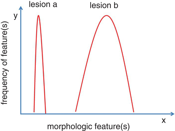 Graph depicts the bell curves that represents the lesion diversity and frequency in which the x-axis can represent a single morphologic feature or set of morphologic features that collectively comprise the lesion in question and the y-axis represents how common the particular morphologic features are within a group of similar lesions and the lesions with a broad curve are morphologically diverse and therefore more difficult to diagnose.