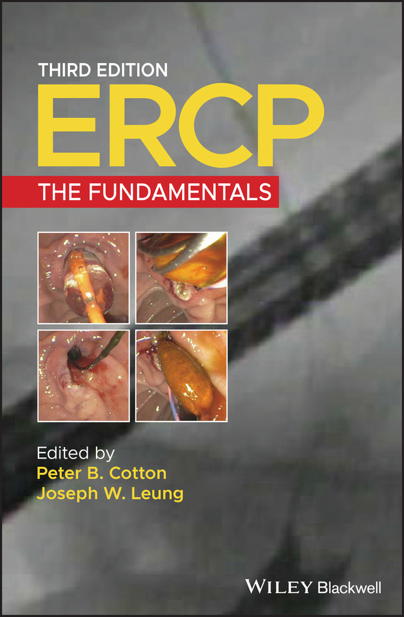 Cover: ERCP, Third Edition, Edited by Joseph W. Leung, Peter B. Cotton